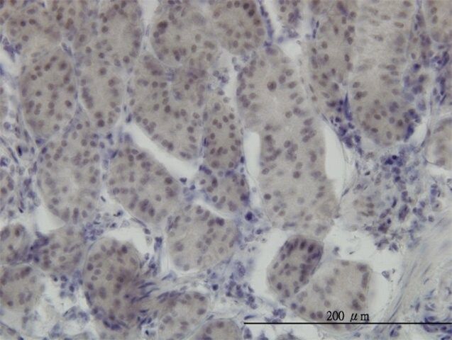 Monoclonal Anti-RUNX1 antibody produced in mouse