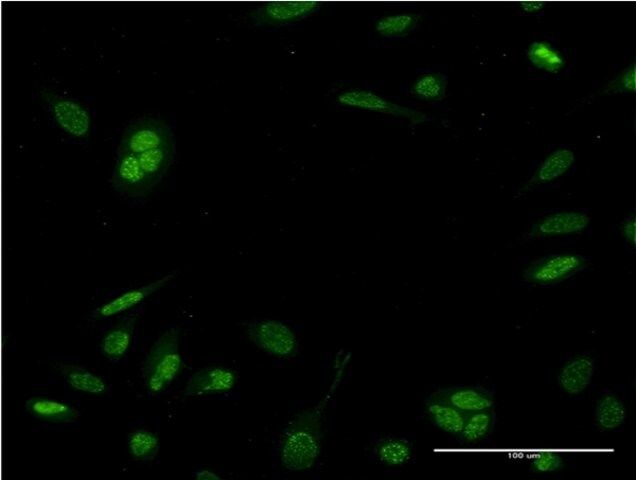 Monoclonal Anti-NEUROD6 antibody produced in mouse