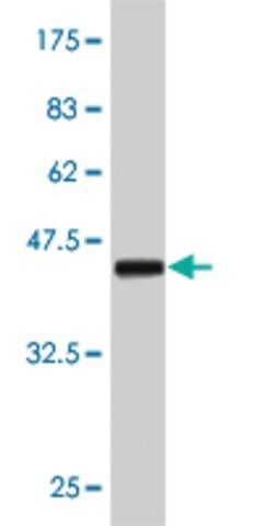 Monoclonal Anti-ERBB2 antibody produced in mouse