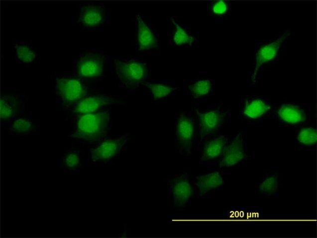 Monoclonal Anti-PDE6D antibody produced in mouse