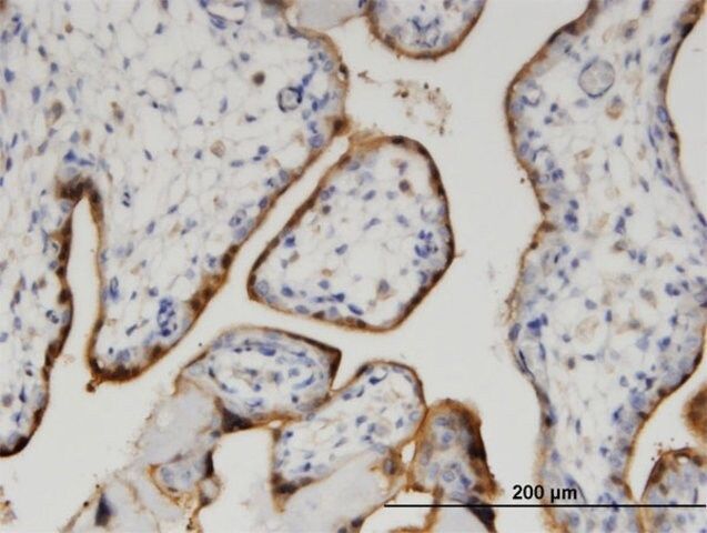 Monoclonal Anti-CLIC5 antibody produced in mouse