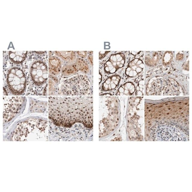 Anti-ZNF521 antibody produced in rabbit