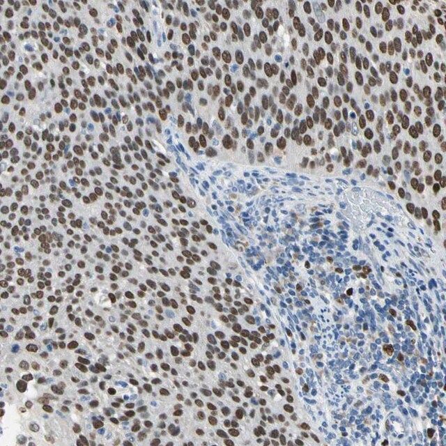 Anti-ZKSCAN3 antibody produced in rabbit