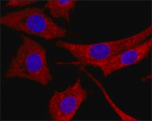 Anti-Galectin-8 antibody, Mouse monoclonal antibody produced in mouse