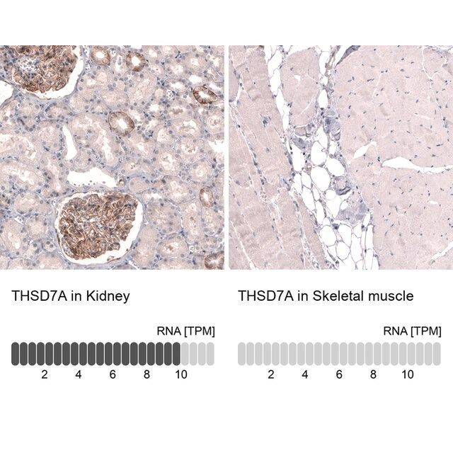 Monoclonal Anti-THSD7A antibody produced in mouse