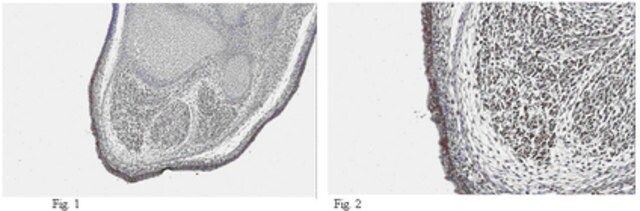 Anti-DLK1 Antibody