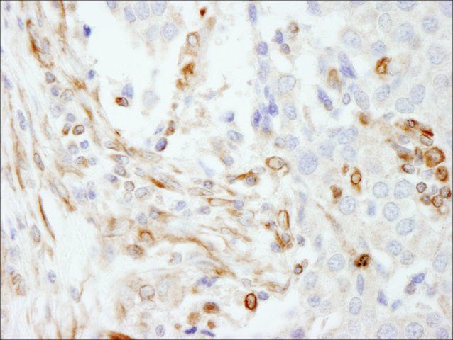 Rabbit anti-Vimentin Antibody, Affinity Purified