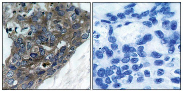 Anti-ASK1 antibody produced in rabbit