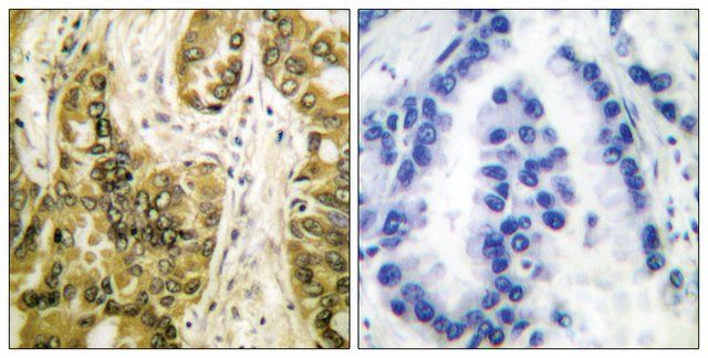 Anti-Galectin 3 antibody produced in rabbit