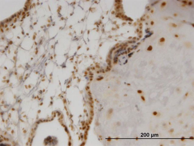 Monoclonal Anti-OLIG2 antibody produced in mouse