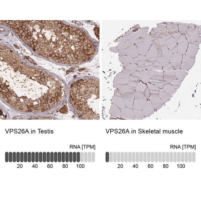 Monoclonal Anti-VPS26A antibody produced in mouse