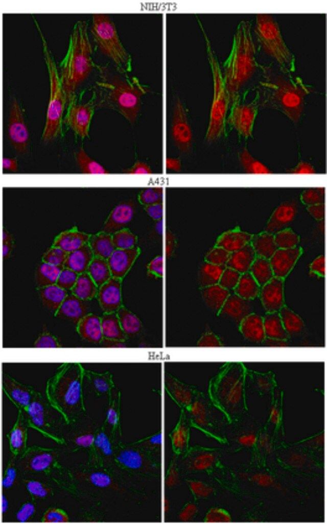 Anti-Smad4/DPC4 Antibody