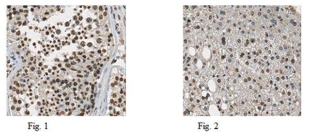 Anti-JMJD2D Antibody