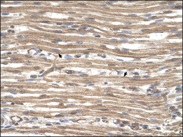 Anti-ACTR2 antibody produced in rabbit