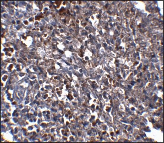 Monoclonal Anti-ORAI1 antibody produced in mouse