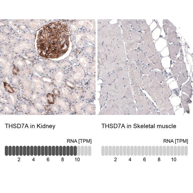 Monoclonal Anti-THSD7A antibody produced in mouse