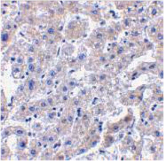 Anti-Caspase-14 Antibody