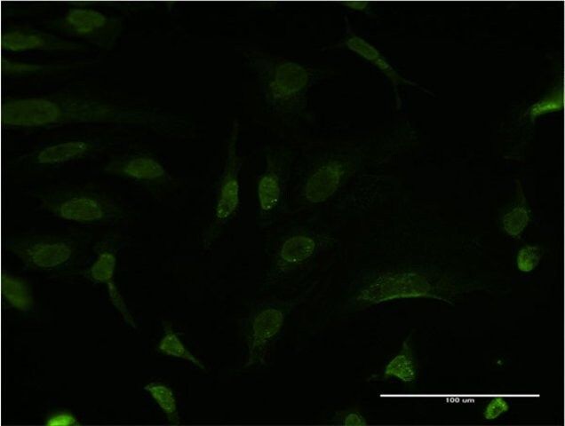 Monoclonal Anti-BCL9 antibody produced in mouse