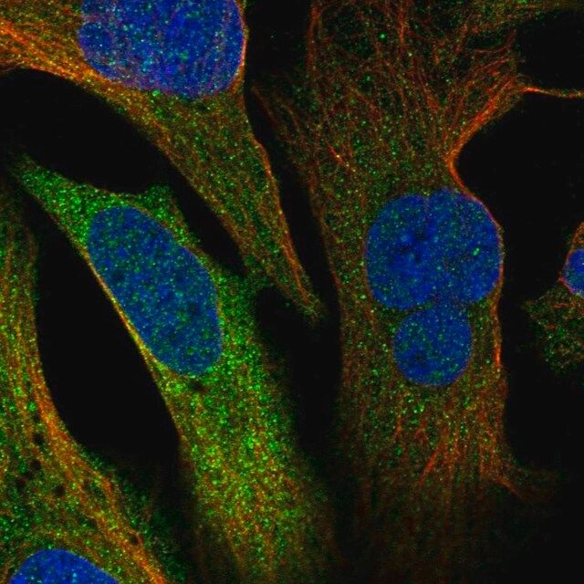 Anti-ERRFI1 antibody produced in rabbit