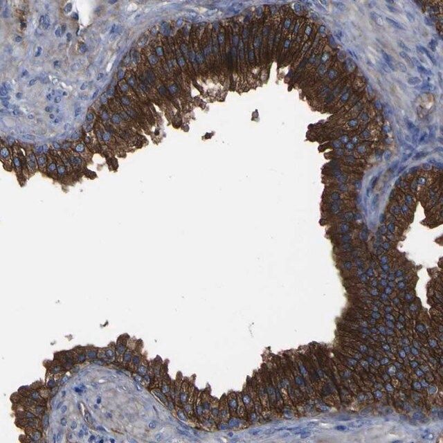 Anti-CD151 antibody produced in rabbit