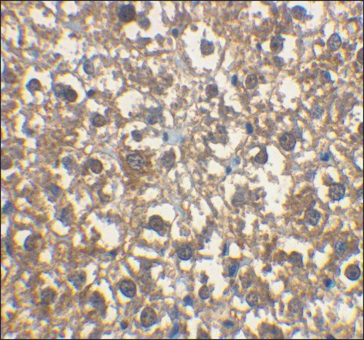 Anti-IRAK-M antibody produced in rabbit