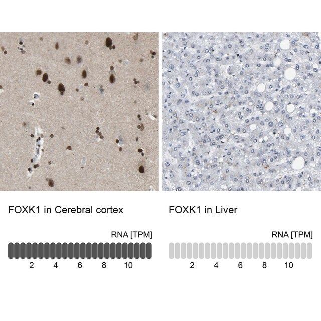 Anti-FOXK1 antibody produced in rabbit