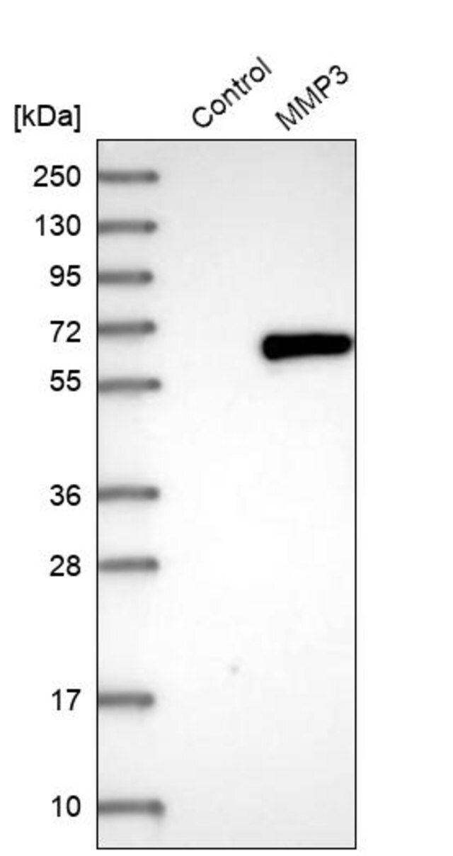 Anti-MMP3 antibody produced in rabbit