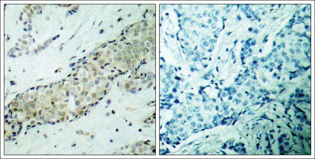 Anti-HDAC5 (Ab-498) antibody produced in rabbit