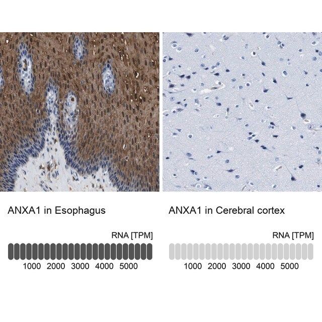 Anti-ANXA1 antibody produced in rabbit