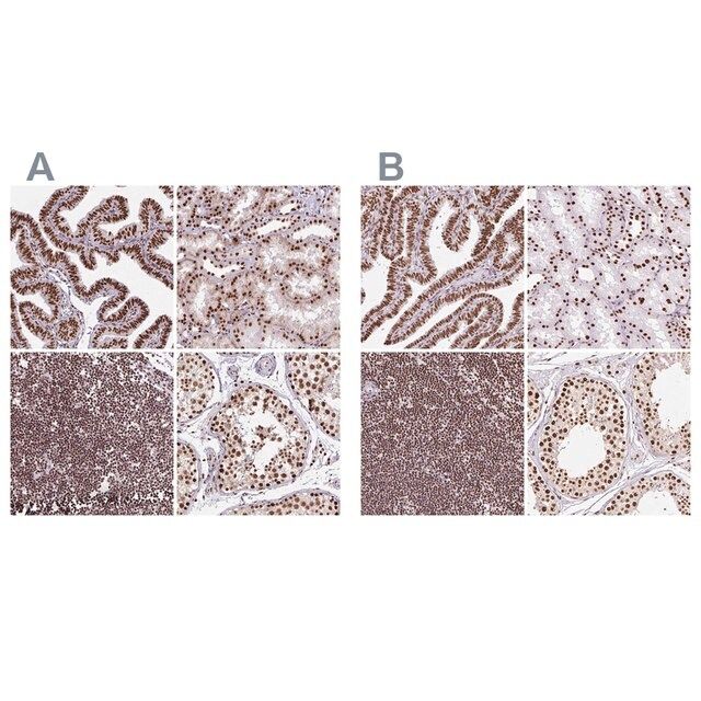 Anti-XRCC6 antibody produced in rabbit