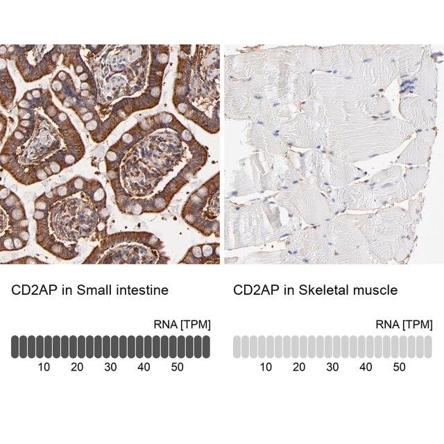 Anti-CD2AP antibody produced in rabbit