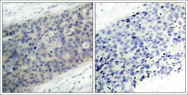 Anti-phospho-LIMK2 (pThr<sup>505</sup>) antibody produced in rabbit