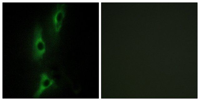 Anti-ADRB2 antibody produced in rabbit