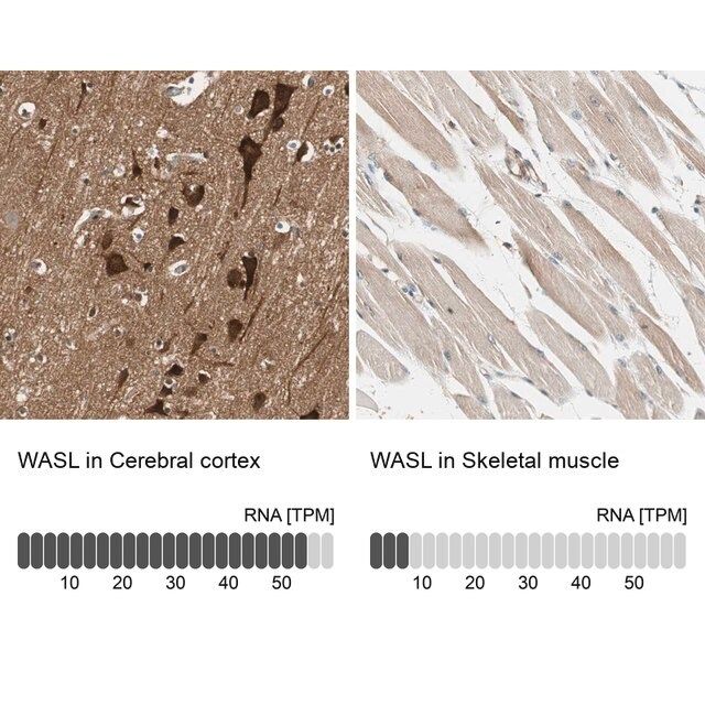 Anti-WASL antibody produced in rabbit