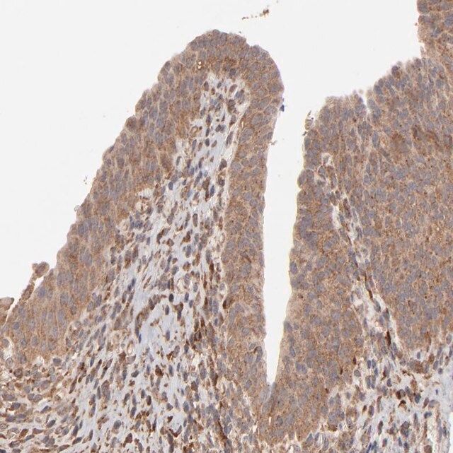 Anti-MMP2 antibody produced in rabbit