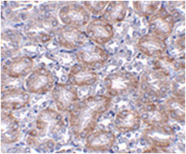 Anti-MTCH2 Antibody