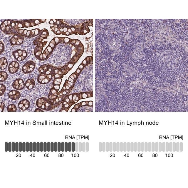 Anti-MYH14 antibody produced in rabbit