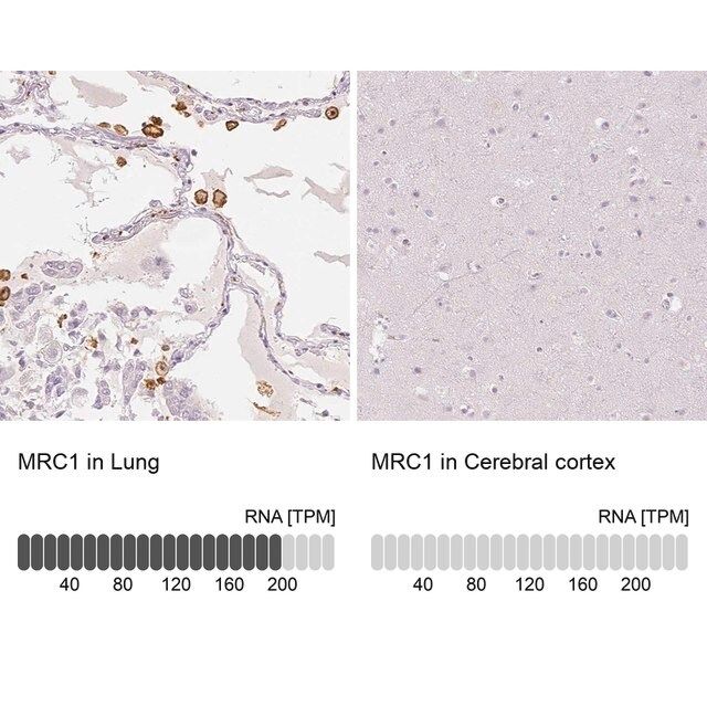 Anti-MRC1 antibody produced in rabbit