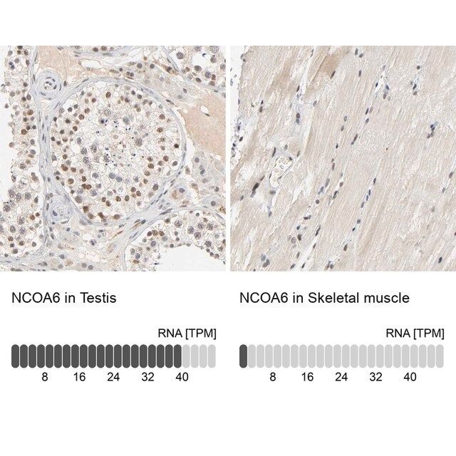 Anti-NCOA6 antibody produced in rabbit