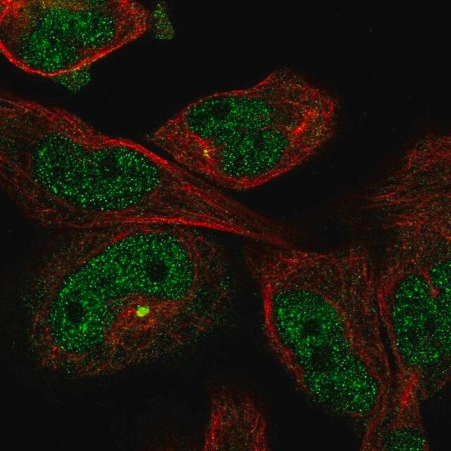 Anti-MYO18B antibody produced in rabbit