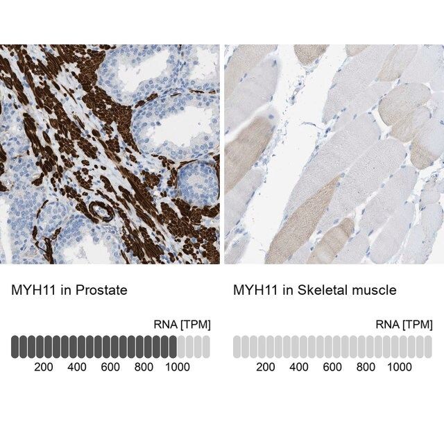 Anti-MYH11 antibody produced in rabbit