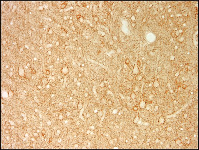 Monoclonal Anti-Glutamic Acid Decarboxylase 67 (GAD67) antibody produced in mouse