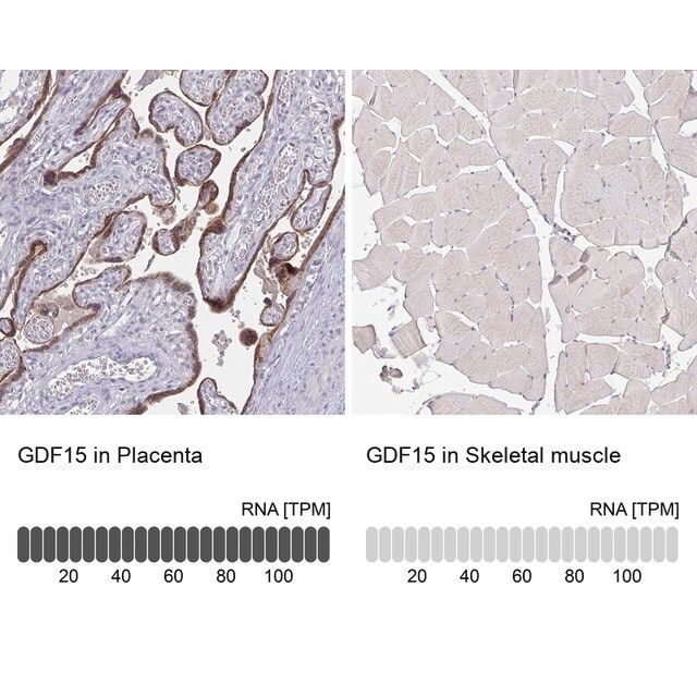 Monoclonal Anti-GDF15 antibody produced in mouse