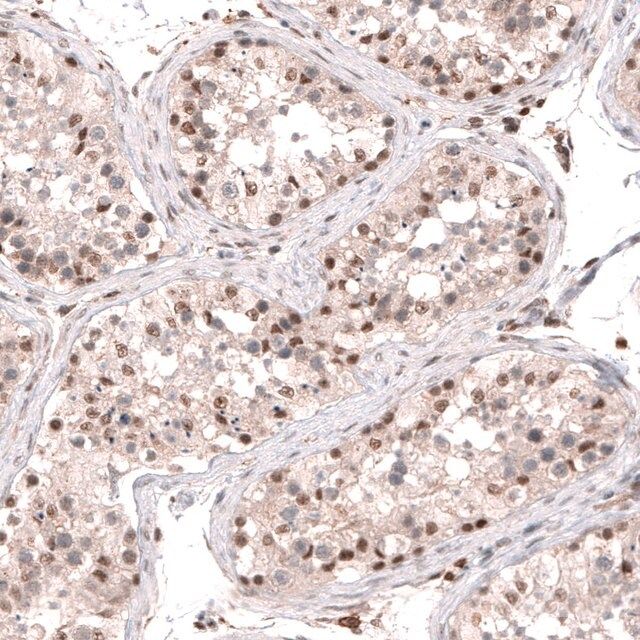 Anti-SMYD2 antibody produced in rabbit