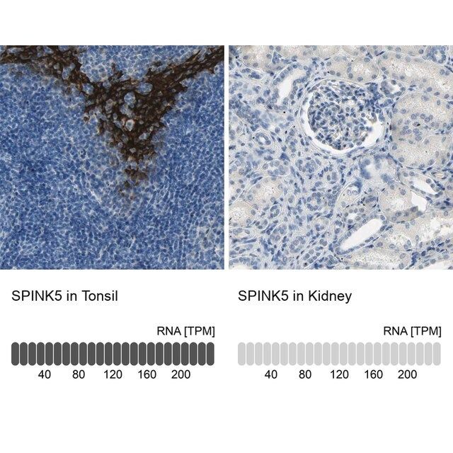 Anti-SPINK5 antibody produced in rabbit