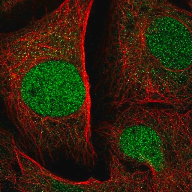 Anti-SPRED1 antibody produced in rabbit