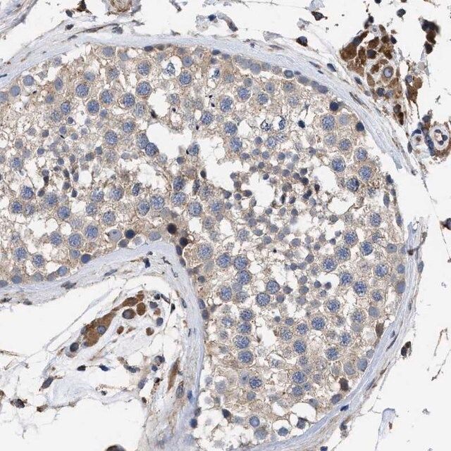 Anti-SQLE antibody produced in rabbit