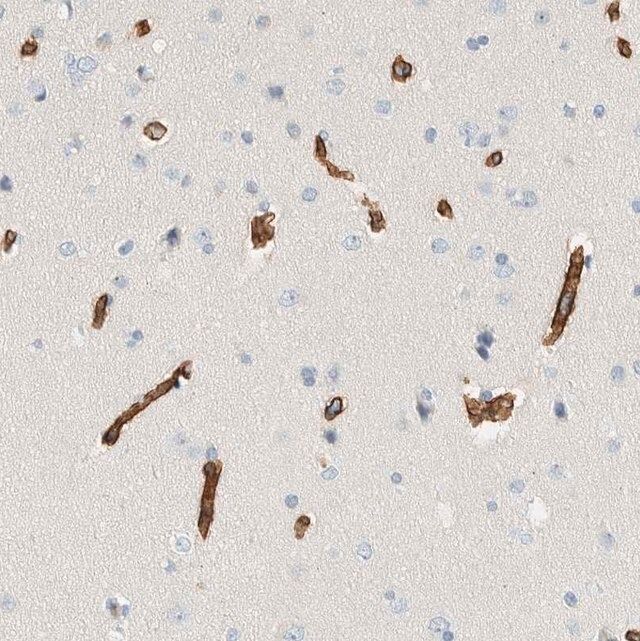 Anti-SLFN12 antibody produced in rabbit