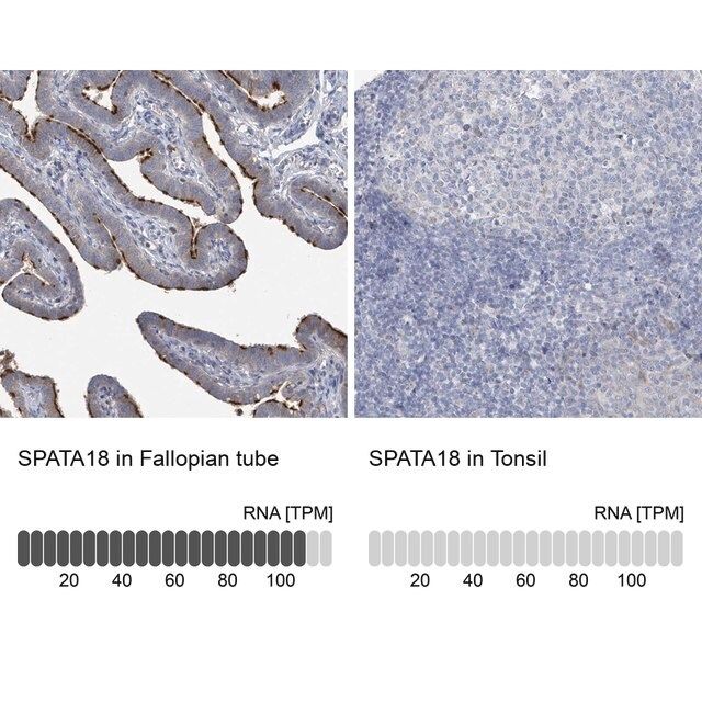 Anti-SPATA18 antibody produced in rabbit