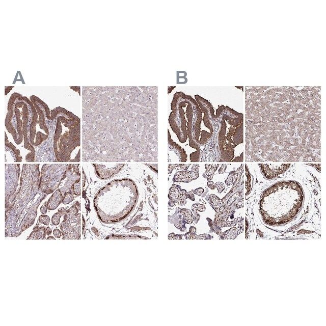 Anti-FMR1 antibody produced in rabbit